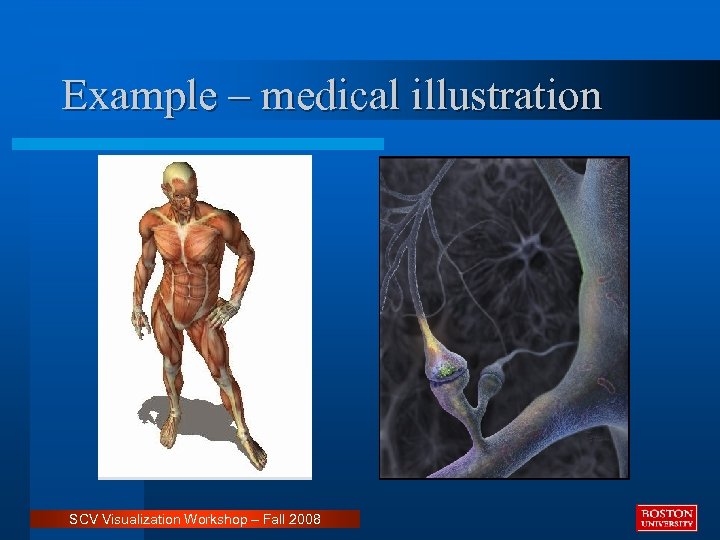 Example – medical illustration SCV Visualization Workshop – Fall 2008 