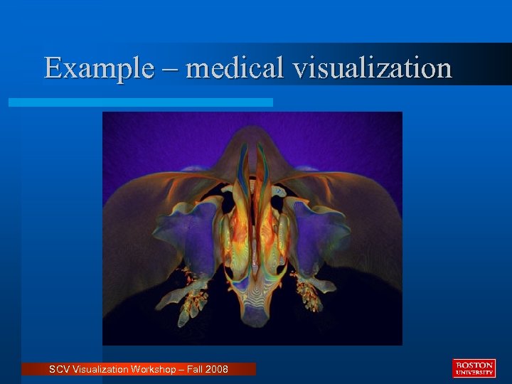 Example – medical visualization SCV Visualization Workshop – Fall 2008 