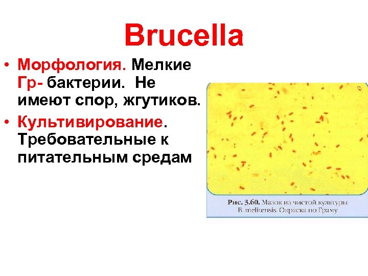 Brucella • Морфология. Мелкие Гр- бактерии. Не имеют спор, жгутиков. • Культивирование. Требовательные к