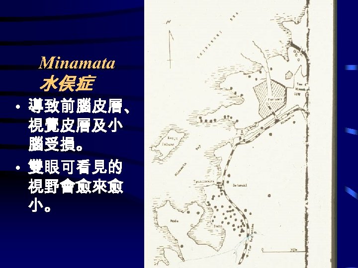 Minamata 水俣症 • 導致前腦皮層、 視覺皮層及小 腦受損。 • 雙眼可看見的 視野會愈來愈 小。 