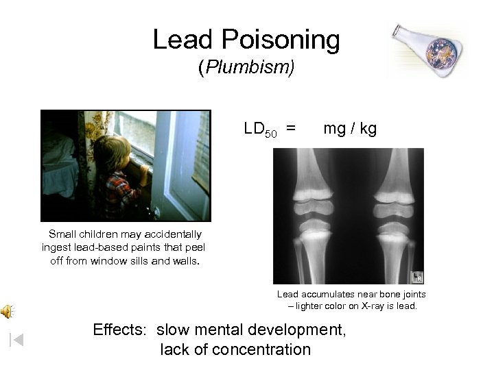 Lead Poisoning (Plumbism) LD 50 = mg / kg Small children may accidentally ingest