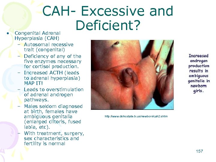  • CAH- Excessive and Deficient? Congenital Adrenal Hyperplasia (CAH) – Autosomal recessive trait