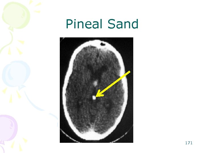 Pineal Sand 171 