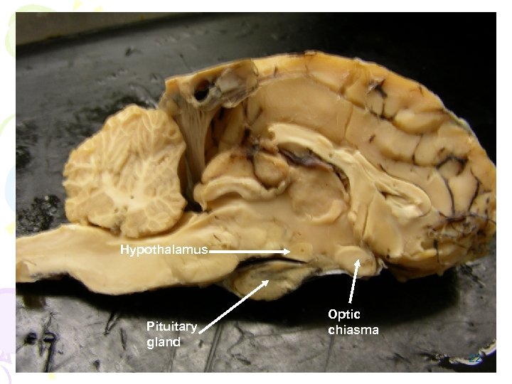 Hypothalamus Pituitary gland Optic chiasma 22 