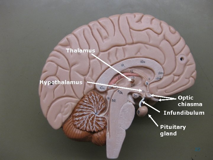 Thalamus Hypothalamus Optic chiasma Infundibulum Pituitary gland 23 