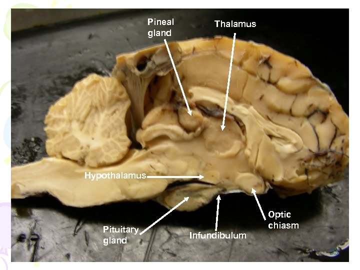 Pineal gland Thalamus Hypothalamus Pituitary gland Optic chiasm Infundibulum 33 