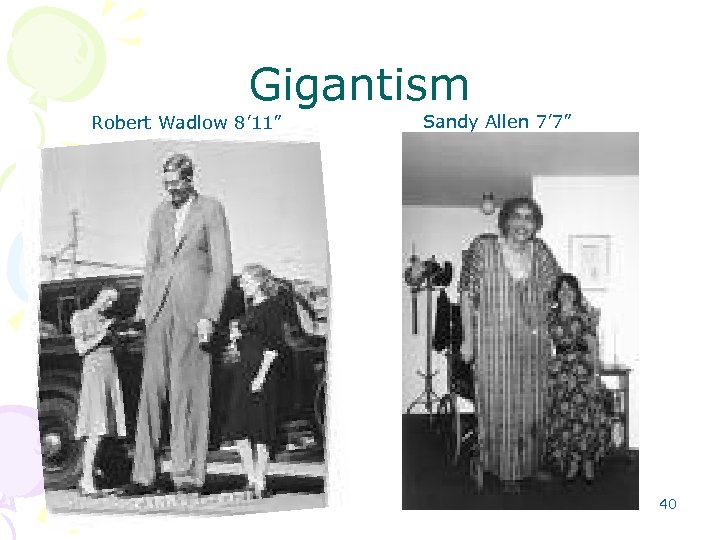 Gigantism Robert Wadlow 8’ 11” Sandy Allen 7’ 7” 40 