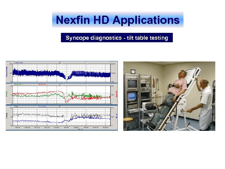 Nexfin HD Applications Syncope diagnostics - tilt table testing 