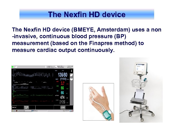 The Nexfin HD device (BMEYE, Amsterdam) uses a non -invasive, continuous blood pressure (BP)