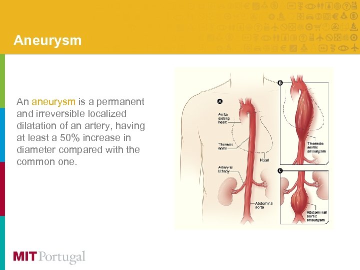 Aneurysm An aneurysm is a permanent and irreversible localized dilatation of an artery, having