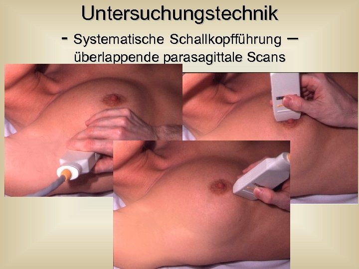Untersuchungstechnik - Systematische Schallkopfführung – überlappende parasagittale Scans 