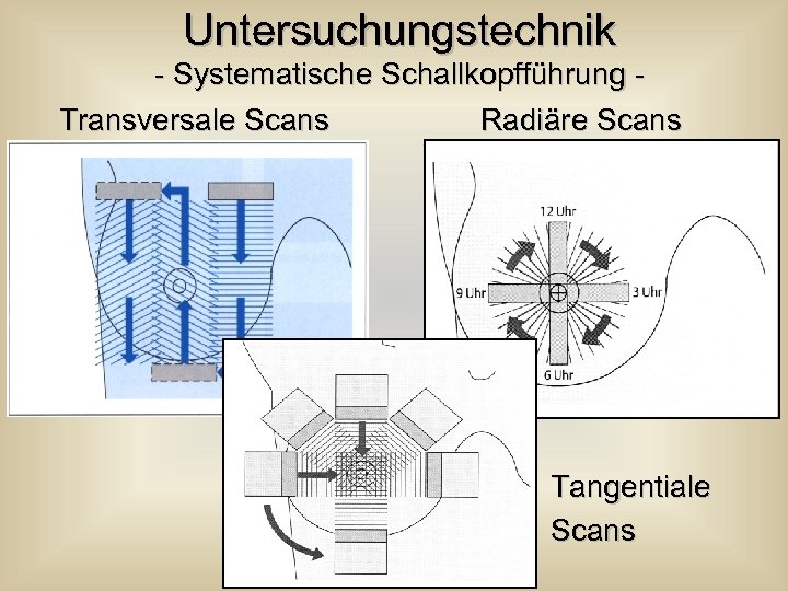 Untersuchungstechnik - Systematische Schallkopfführung Transversale Scans Radiäre Scans Tangentiale Scans 