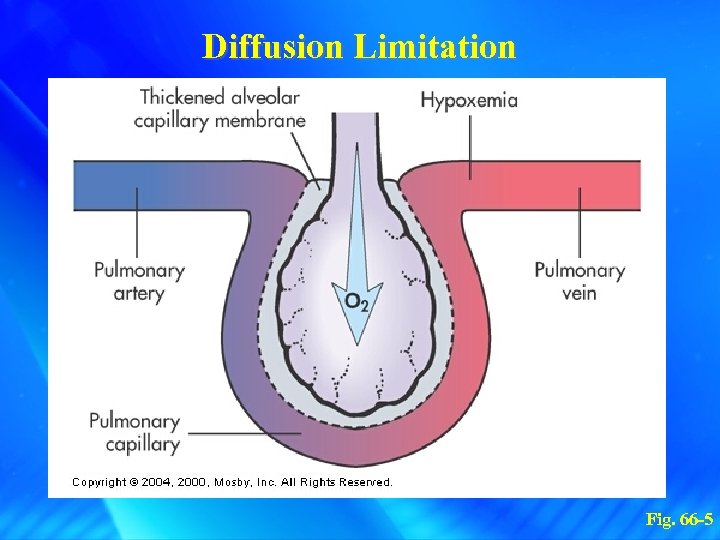 Diffusion Limitation Fig. 66 -5 