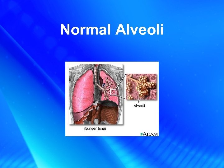Normal Alveoli 