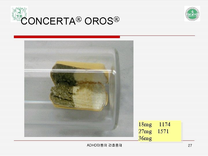 CONCERTA® OROS® 18 mg 27 mg 36 mg ADHD아동의 간호중재 1174 1571 27 