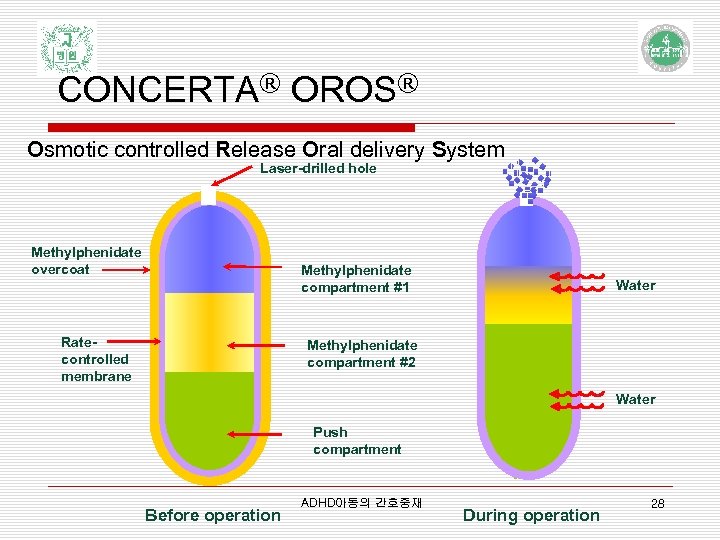 CONCERTA® OROS® Osmotic controlled Release Oral delivery System Laser-drilled hole Methylphenidate overcoat Methylphenidate compartment