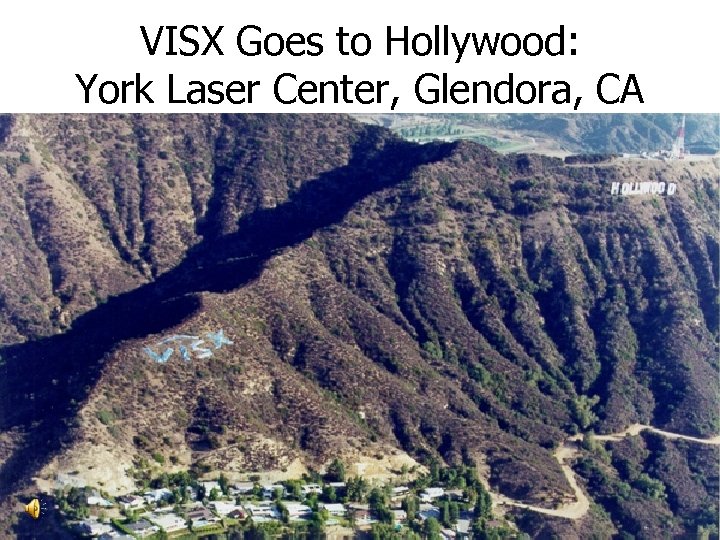 VISX Goes to Hollywood: York Laser Center, Glendora, CA 
