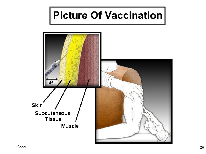 Picture Of Vaccination 45 o Skin Subcutaneous Tissue Muscle Approved: 9 Jun 1999 20