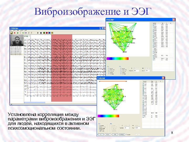 Виброизображение и ЭЭГ Установлена корреляция между параметрами виброизображения и ЭЭГ для людей, находящихся в