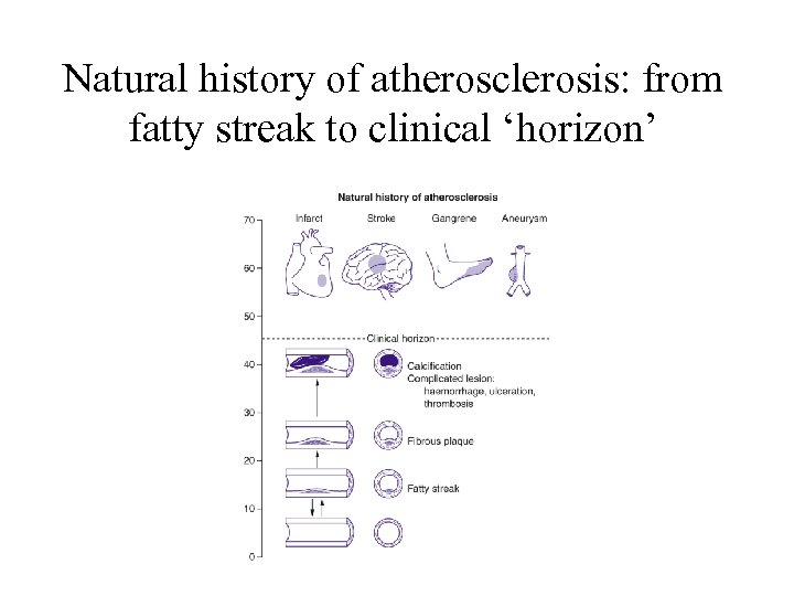 Natural history of atherosclerosis: from fatty streak to clinical ‘horizon’ 