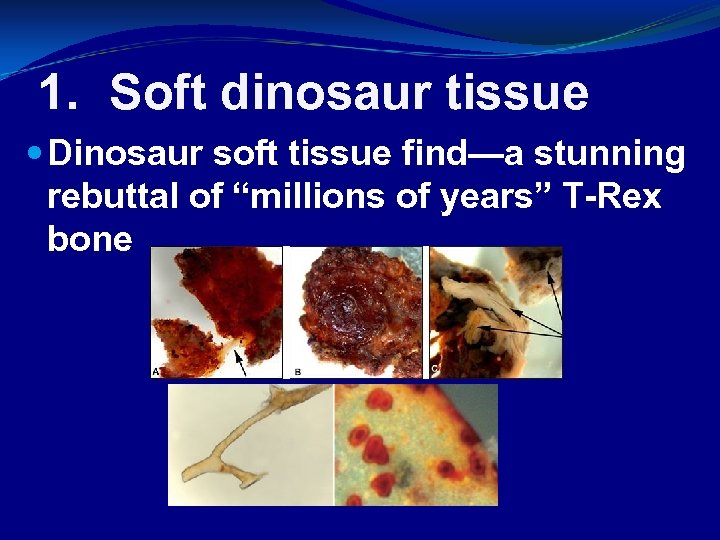 1. Soft dinosaur tissue Dinosaur soft tissue find—a stunning rebuttal of “millions of years”