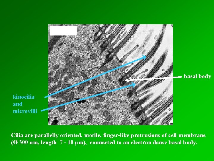basal body kinocilia and microvilli Cilia are parallelly oriented, motile, finger-like protrusions of cell