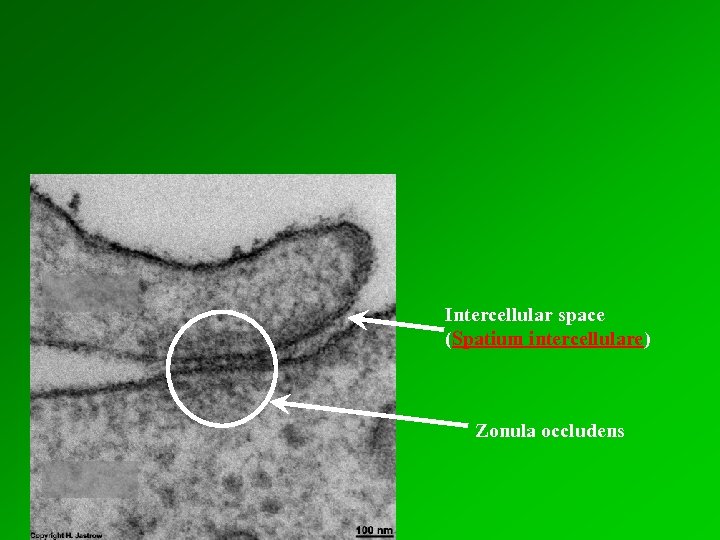 Intercellular space (Spatium intercellulare) Zonula occludens 