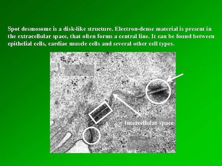 Spot desmosome is a disk-like structure. Electron-dense material is present in the extracellular space,