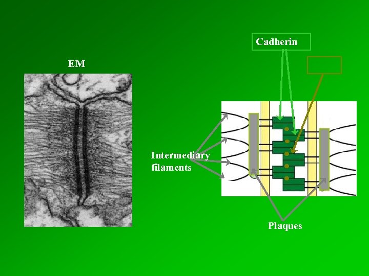 Cadherin EM Intermediary filaments Plaques 