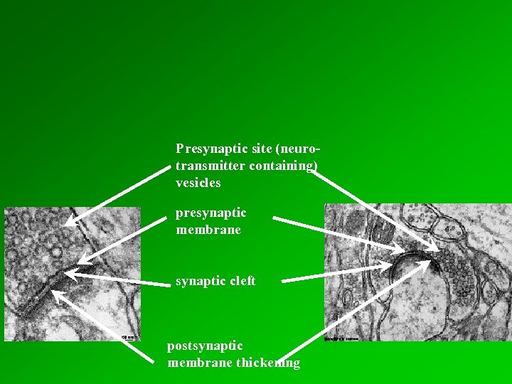 Presynaptic site (neurotransmitter containing) vesicles presynaptic membrane synaptic cleft postsynaptic membrane thickening 