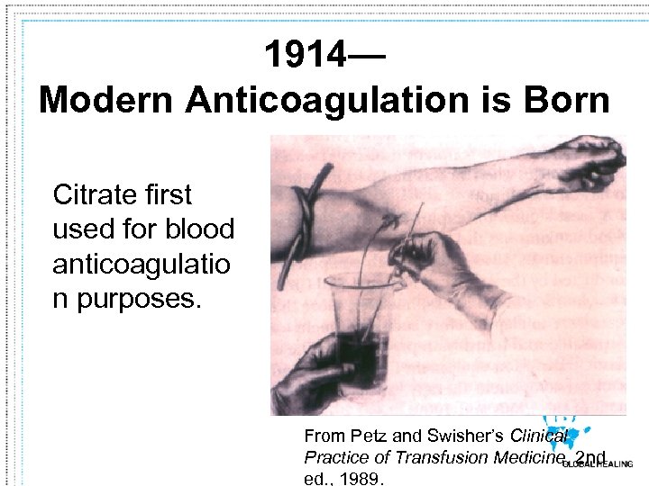 1914— Modern Anticoagulation is Born Citrate first used for blood anticoagulatio n purposes. From