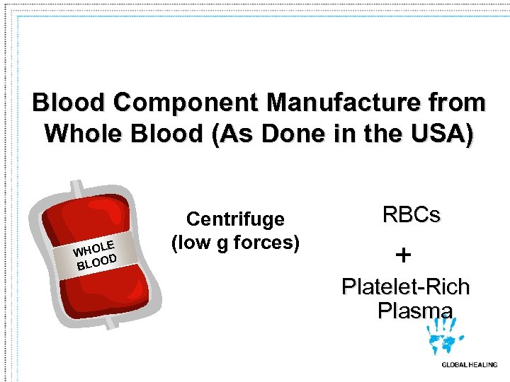 Blood Component Manufacture from Whole Blood (As Done in the USA) LE WHO D