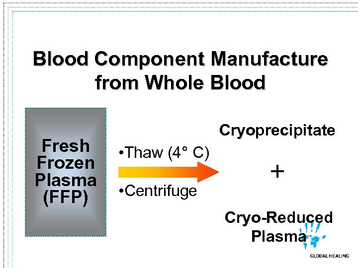 Blood Component Manufacture from Whole Blood Fresh Frozen Plasma (FFP) Cryoprecipitate • Thaw (4°