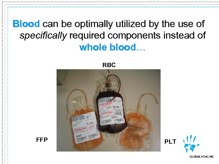 Blood can be optimally utilized by the use of specifically required components instead of