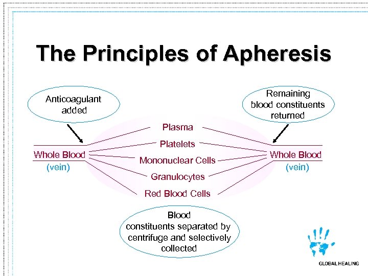 The Principles of Apheresis Remaining blood constituents returned Anticoagulant added Plasma Platelets Whole Blood