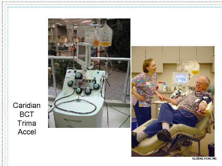 Caridian BCT Trima Accel 