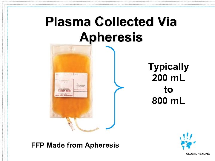Plasma Collected Via Apheresis Typically 200 m. L to 800 m. L FFP Made
