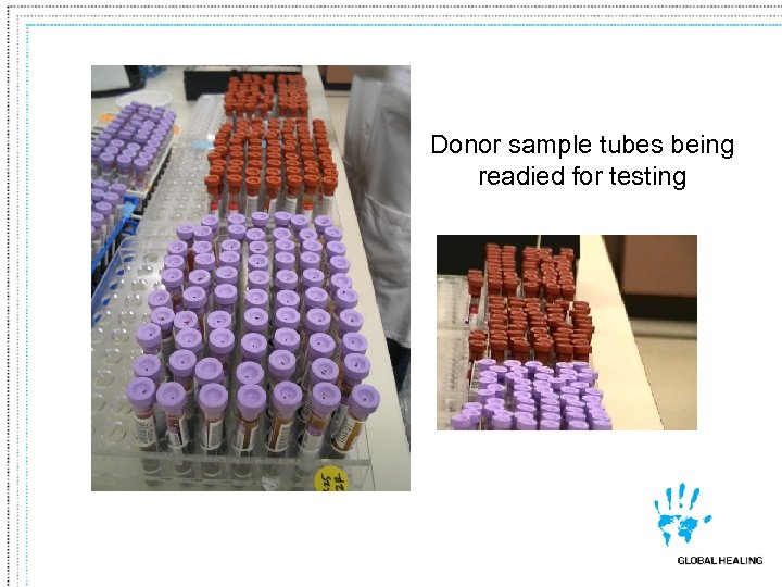 Donor sample tubes being readied for testing 