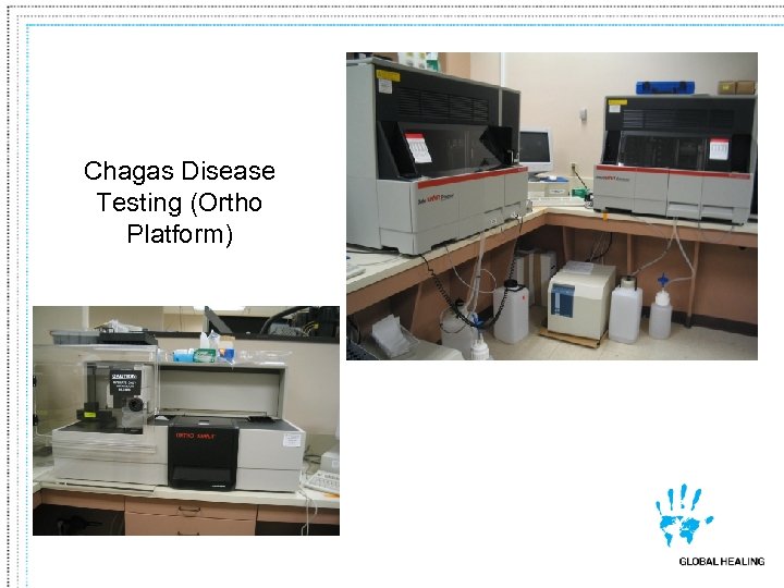 Chagas Disease Testing (Ortho Platform) 