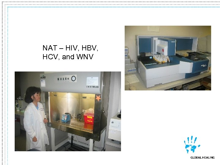 NAT – HIV, HBV, HCV, and WNV 