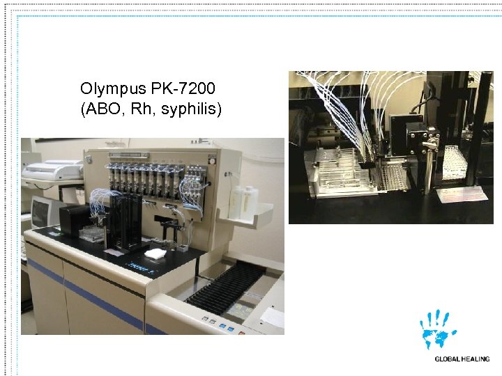 Olympus PK-7200 (ABO, Rh, syphilis) 
