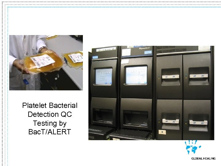 Platelet Bacterial Detection QC Testing by Bac. T/ALERT 