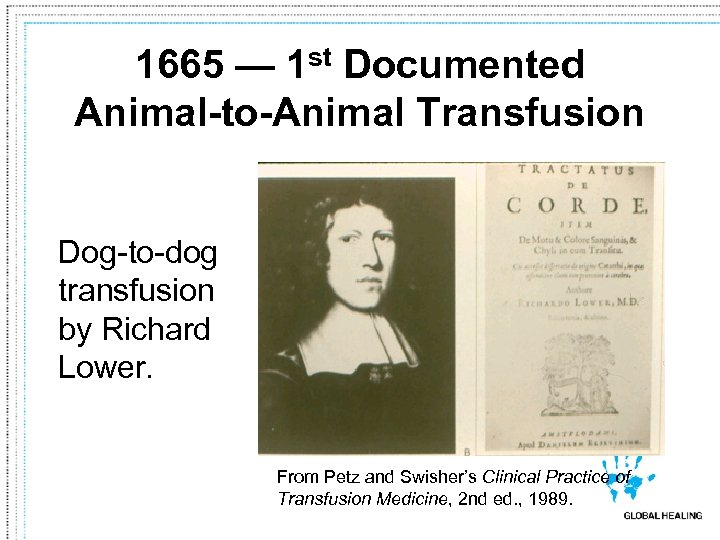 1665 — 1 st Documented Animal-to-Animal Transfusion Dog-to-dog transfusion by Richard Lower. From Petz
