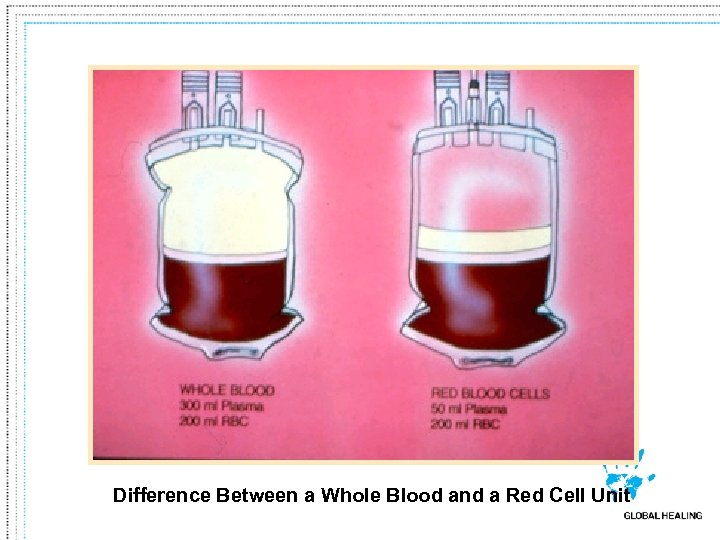 Difference Between a Whole Blood and a Red Cell Unit 