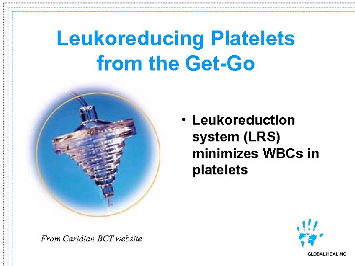 Leukoreducing Platelets from the Get-Go • Leukoreduction system (LRS) minimizes WBCs in platelets From