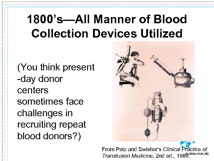 1800’s—All Manner of Blood Collection Devices Utilized (You think present -day donor centers sometimes