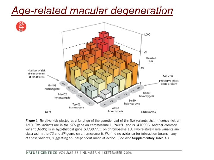 Age-related macular degeneration 
