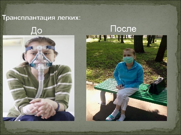 До После 