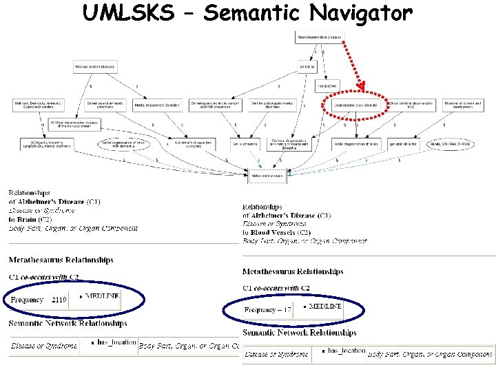 UMLSKS – Semantic Navigator 