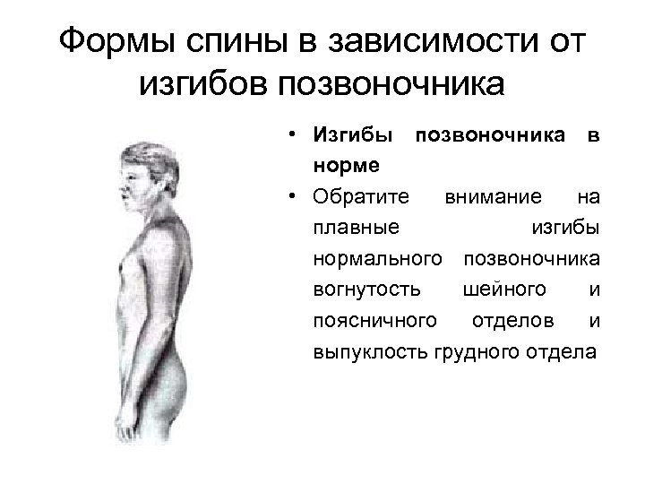 Формы спины в зависимости от изгибов позвоночника • Изгибы позвоночника в норме • Обратите